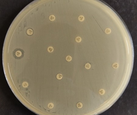 Você está visualizando atualmente Risco global: bactéria multirresistente é encontrada em paciente brasileira