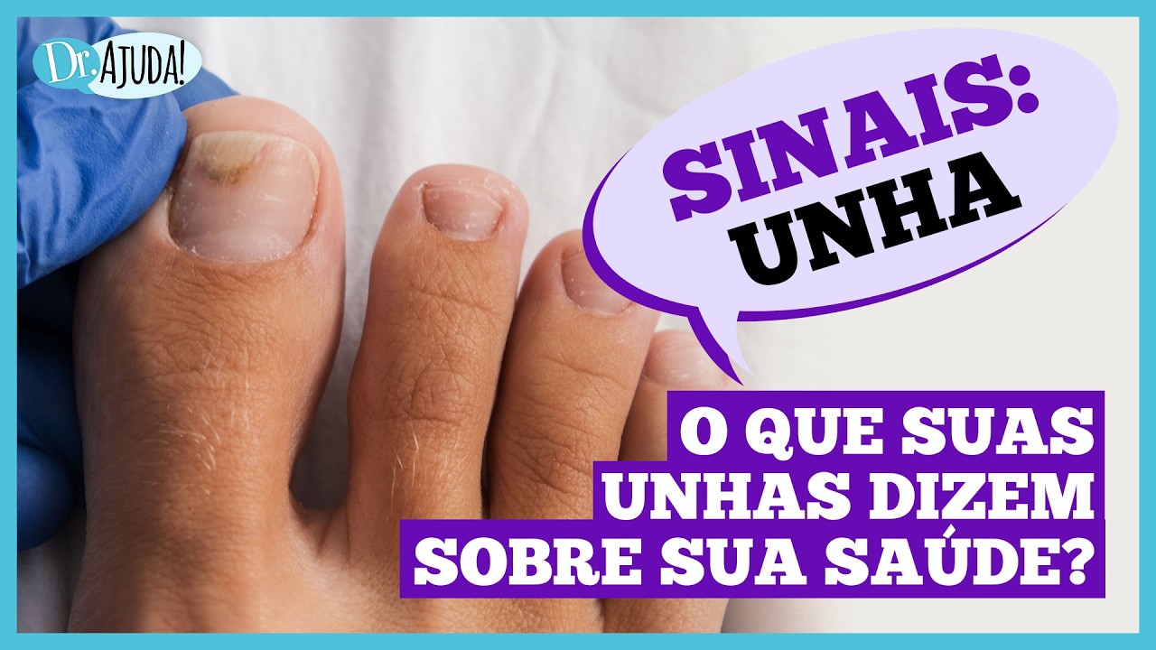 Você está visualizando atualmente Dr. Ajuda: Unhas fracas podem indicar problemas de saúde
