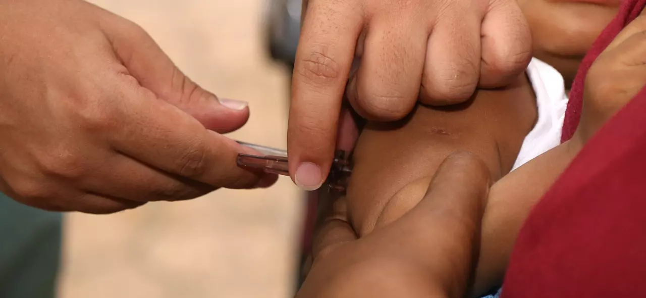 Você está visualizando atualmente SARAMPO: cobertura na região Norte está próxima da meta de 95% para a primeira dose