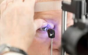 Leia mais sobre o artigo Transplante de córnea: 33 mil pessoas aguardam cirurgia no Brasil