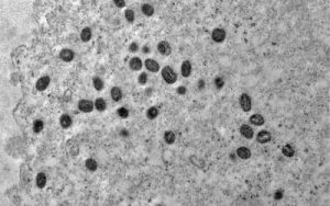 Leia mais sobre o artigo Mpox: São Paulo confirma segundo caso da doença pela nova cepa clado Ib